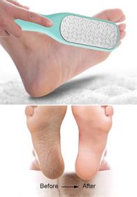 img 1 attached to Средство для удаления мозолей Professional Scrubber Pedicure