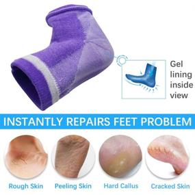 img 2 attached to 💧 Moisturizing Socks, 3 Pairs - Gel Heel Socks for Dry Cracked Heels with Open Toe Design and Ventilated Gel Spa Socks, Infused with Vitamins (Blue, Purple, Black)