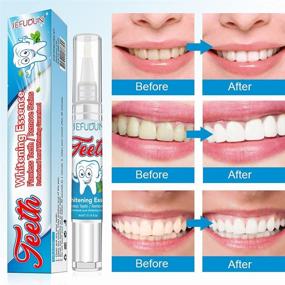 img 2 attached to 😁 Teeth Whitening Pen: Effective, Painless, Non-Sensitive, Easy-to-Travel Whitening Kit - Remove Year Stains, Beautiful White Smile with Natural Mint Flavor (Pack of 1)