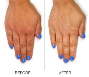 img 1 attached to 👐 LONDONTOWN Kur Serum - Transform Your Hands and Nails with this 2-in-1 Treatment, 1 oz