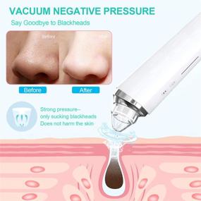 img 1 attached to 📷 Беспроводная камера для очистки пор Blackhead Pore Vacuum Cleanser - BQQCSTY WiFi визуальный экстрактор прыщей Comedone Whitehead - 3 уровня всасывания и 6 сменных насадок с микроскопической камерой 20X