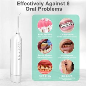 img 3 attached to 🚰 Portable Travel Water Flosser for Teeth - Effective Dental Oral Irrigator with 3 Cleaning Modes, IPX7 Waterproof, and 2 Jet Tips