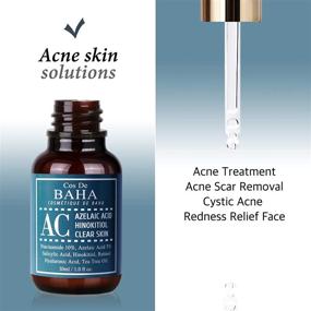 img 1 attached to 🌟 Clear Skin Facial Serum with Azelaic Acid, Tea Tree, Niacinamide 10%, Salicylic Acid, and Retinol - Fast & Efficient Formula for Cystic Acne, Age-Defying, and Trouble Skin Relief, 1 Fl Oz (30ml)