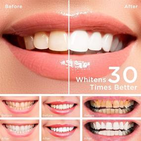 img 1 attached to 🌟 Пенка для отбеливания зубов Soniultra - 4 штуки | Более 70 применений | Эффективное, безболезненное, без чувствительности | Легко использовать для восхитительно белой улыбки