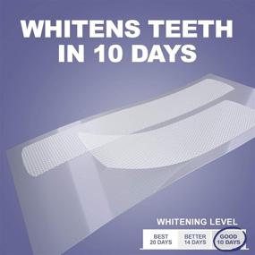 img 3 attached to 🦷 Solimo Teeth Whitening Strips - 10 Day Kit, 10 Treatments