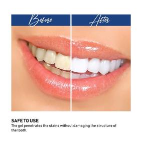 img 1 attached to 🦷 Vivostar Teeth Whitening Kit - (3) 3ml Whitening Gel + (1) 3ml Desensitizing Gel | Premium Quality for Sensitive Smiles