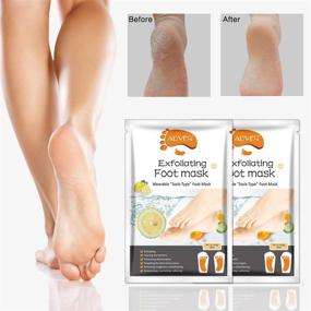 img 3 attached to 🦶 Foot Peel Mask (3 Pack) - Exfoliating Treatment for Cracked Heels, Rough Skin, and Calluses - Repairing Dead Skin and Restoring Smoothness