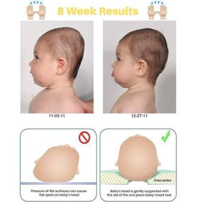 img 3 attached to Infant Head Shaping Pillow for Flat Head Prevention: Prevent Plagiocephaly & Ensure Proper Head Development (0-12 months)