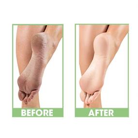 img 3 attached to 👣 ProLinc Dry Heel Eliminator: Effective dry heel and foot protection and hydration - 4 oz