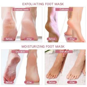 img 2 attached to 👣 Revitalize Your Feet with Foot Peel Mask 4 Pack - Exfoliate, Moisturize, and Whiten Your Skin