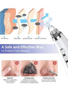 img 3 attached to 🔌 2021 Upgraded EUASOO Blackhead Pore Vacuum Cleaner Remover - Facial Pore Cleaner Electric USB Rechargeable Acne Comedone Whitehead Extractor with 5 Probes and Blackhead Remover Kit Suction (White)