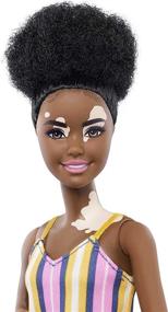 img 2 attached to 🎀 Exclusive Vitiligo Accessories for Barbie Fashionistas