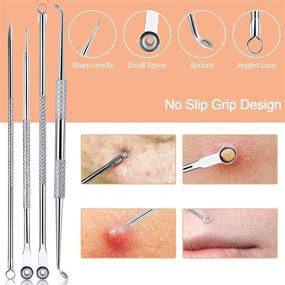 img 1 attached to 🔳 10-Piece Blackhead Remover Pimple Popper Tool Kit for Acne, Whitehead & Zit Removal - Silver