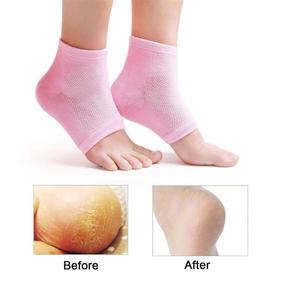 img 2 attached to 👣 Revitalize & Repair Your Heels with 4 Pairs of Vented Moisturizing Gel Heel Socks - Open Toe Silicone Spa Gel Socks for Women and Men