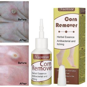 img 2 attached to 🌽 Corn Remover Liquid for Foot Corns and Calluses - 15ml
