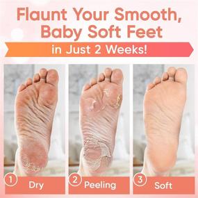 img 2 attached to Peach Foot Peel Mask (2 Pairs) – Ultimate Foot Treatment for Smooth and Dead Skin-Free Feet with Aloe Vera Gel and Natural Peach Extract – Perfect Foot Peeling Mask for Men and Women