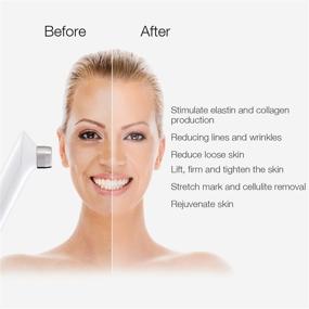 img 3 attached to 💆 MLAY RF Facial and Body Skin Tightening Machine - Professional RF Lifting Skin Care Anti Aging Device for Home and Salon Effects