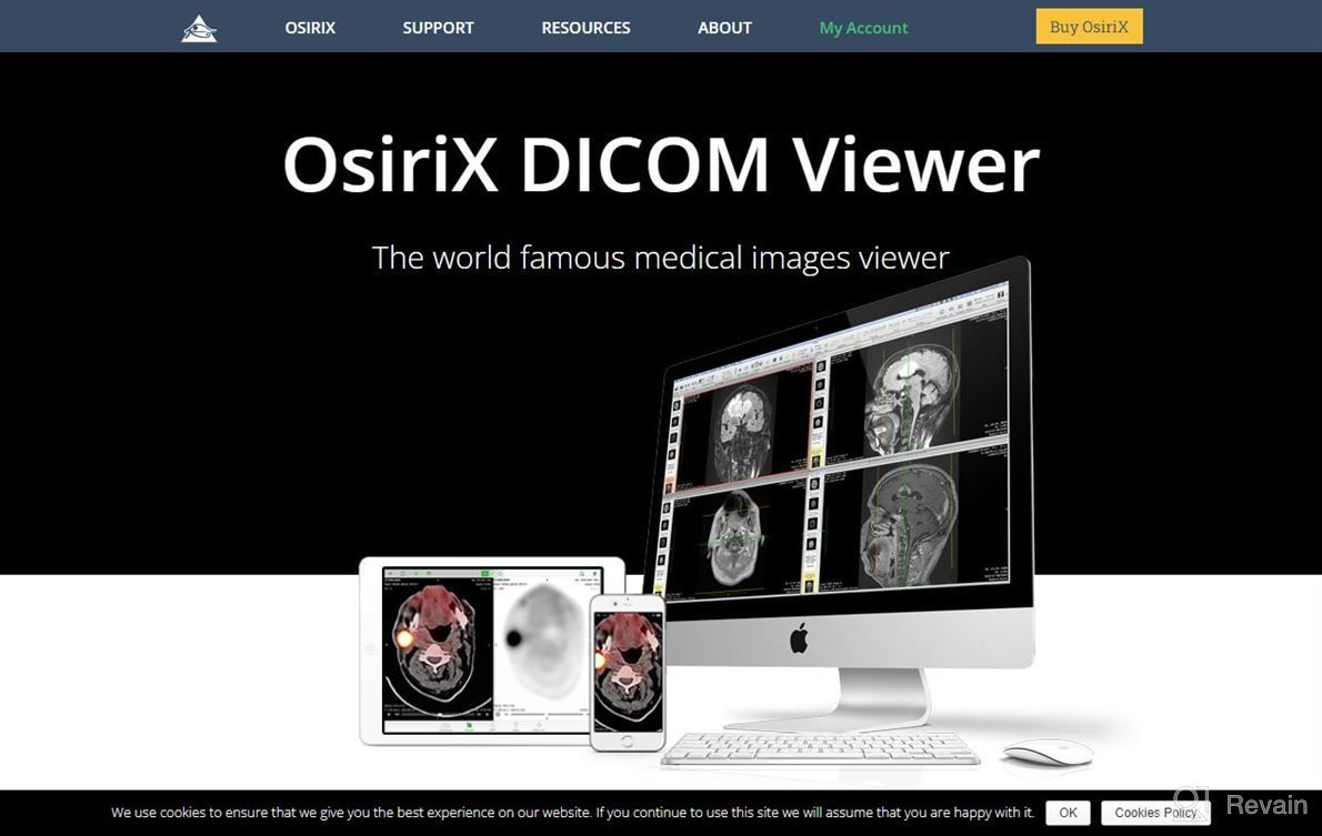 img 1 attached to OsiriX MD review by Tim Burns