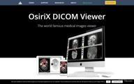 картинка 1 прикреплена к отзыву OsiriX MD от Tim Burns