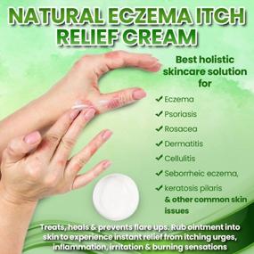 img 3 attached to Natrulo'S Herbal Eczema &amp; Psoriasis Cream - увлажняющий лосьон-мазь для чувствительной кожи у взрослых, детей и младенцев