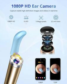 img 3 attached to Wireless 1080P FHD Otoscope With Ear Camera And 6 Ear Spoons - UNOISETION Ear Wax Removal Tool Kit For Kids And Adults Compatible With IPhone, IPad, And Android - White