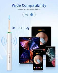 img 2 attached to Wireless 1080P FHD Otoscope With Ear Camera And 6 Ear Spoons - UNOISETION Ear Wax Removal Tool Kit For Kids And Adults Compatible With IPhone, IPad, And Android - White