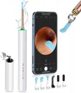 wireless 1080p fhd otoscope with ear camera and 6 ear spoons - unoisetion ear wax removal tool kit for kids and adults compatible with iphone, ipad, and android - white logo