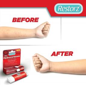 img 3 attached to Get Fast Relief Anywhere With Restorz Hydrocortisone 1% Cream Treatment Stick (2 Pack) - Easy To Apply, Travel-Friendly Solution For Itches, Bites, Redness, And Rashes