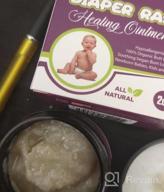 img 1 attached to Organic Diaper Rash Healing Ointment By Natrulo - All Natural Butt Balm For Quick Itch Relief - Hypoallergenic And Vegan Formula For Newborns, Kids, And Adults - Soothe And Protect Your Baby'S Skin review by Elvis Kimbro