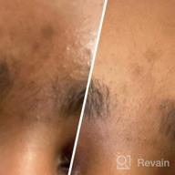 картинка 1 прикреплена к отзыву 🔆 Ebanel Dark Spot Remover Cream for Face - Skin Brightening, Melasma, Hyperpigmentation and Sun Spot Treatment - Age Spot, Freckle Fade Cream with Synovea, 4-Butylresorcinol, Niacinamide, Glutathione от Jessie Burgos