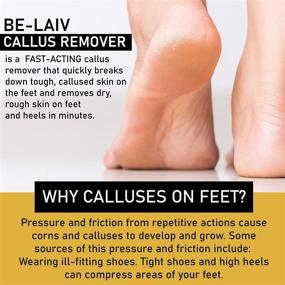 img 3 attached to 🩺 Pedi-Live Pro 0-Minute Callus Eliminator