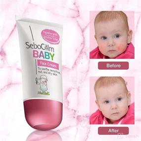 img 2 attached to 👶 SeboCalm Baby Face Cream Lotion: Gentle Hypoallergenic Vegan Facial Moisturizer for Newborns and Toddlers with Dry Rash and Sensitive Skin