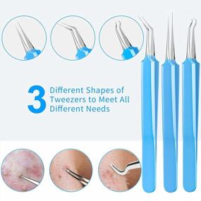 img 1 attached to 2023 Latest 15 PCS Pimple Popper Tool Kit - Professional Sharp Stainless Skin Blemish Removal For Blackhead Remover & Acne Extractor