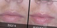 картинка 1 прикреплена к отзыву 🔆 Ebanel Dark Spot Remover Cream for Face - Skin Brightening, Melasma, Hyperpigmentation and Sun Spot Treatment - Age Spot, Freckle Fade Cream with Synovea, 4-Butylresorcinol, Niacinamide, Glutathione от Mike Roberts