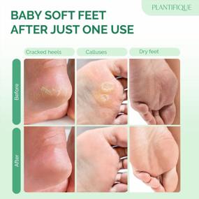 img 2 attached to Get Baby Soft Feet With Plantifique'S 4-Pc Family Pack Foot Peel Mask - Dermatologically Tested For Peeling, Repairing Heels & Removing Dead Skin - Exfoliating Solution For Dry Cracked Feet