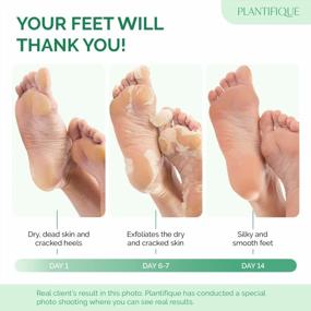 img 3 attached to Get Baby Soft Feet With Plantifique'S 4-Pc Family Pack Foot Peel Mask - Dermatologically Tested For Peeling, Repairing Heels & Removing Dead Skin - Exfoliating Solution For Dry Cracked Feet