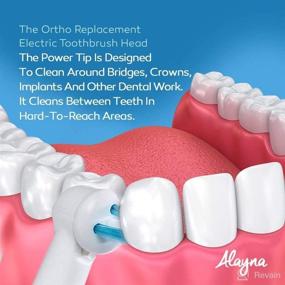 img 2 attached to 🦷 Unleash Orthodontic Success with the Ultimate Power Ortho Replacement Brush